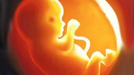 abortion